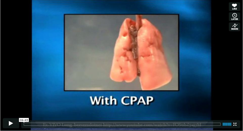 B-CPAP