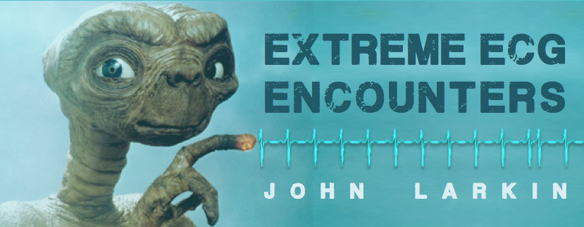 JOHN LARKIN: EXTREME ECG ENCOUNTERS