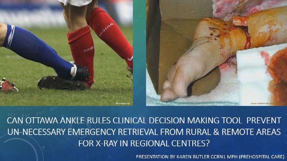 Ottawa Ankle Rules Clinical Decision Making Tool for Rural & Remote Clinicians
