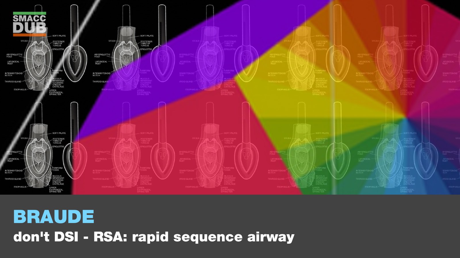 Braude - Don't DSI - RSA- rapid sequence airway
